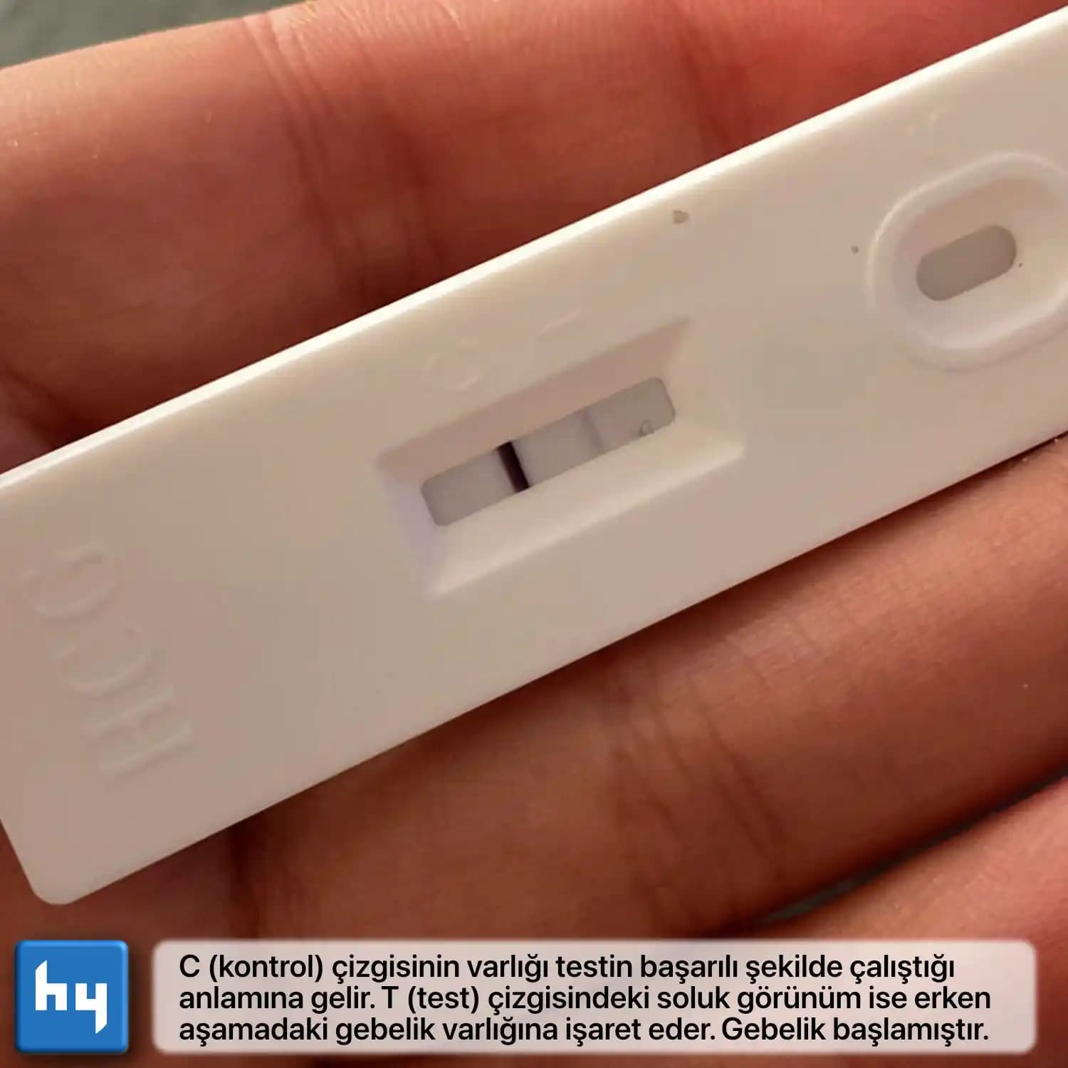 Gebelik Testleri: Doğruluk, Zamanlama ve En İyi Uygulama Yöntemleri