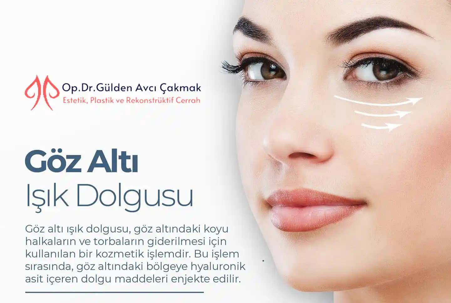 Göz Altı Morlukları ve Etkili Tedavi Yöntemleri Hakkında Kapsamlı Bilgi