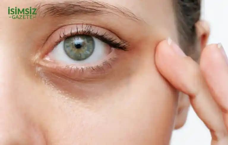 Göz Altı Morluklarının Nedenleri ve Etkili Çözüm Yöntemleri Hakkında Bilgiler