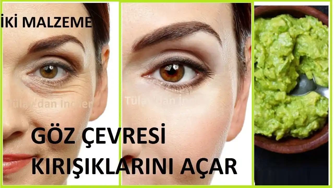 Göz Çevresi Bakımında Etkili ve Güvenilir Çözüm Yöntemleri ve Ürün Seçimi