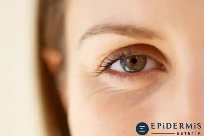 Göz Kırışıklıklarını Azaltma Yöntemleri: Klinik ve Doğal Yaklaşımlar