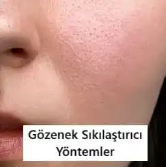 Gözenek Daraltma ve Cilt Yenileme Yöntemleri: Güncel Teknikler ve Tavsiyeler