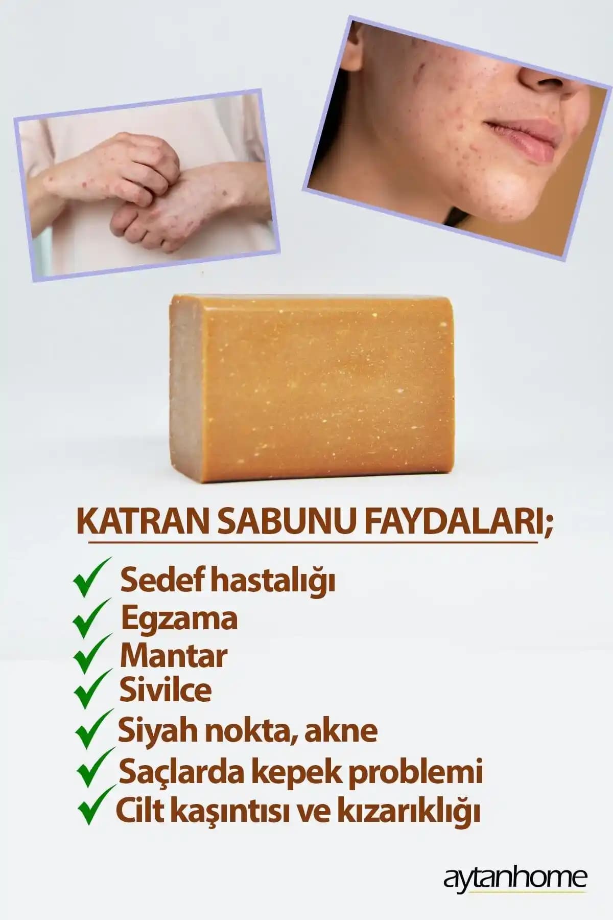 Güvenilir Sivilce Sabunu Seçimi ve Cilt Sağlığı İçin Bilmeniz Gerekenler