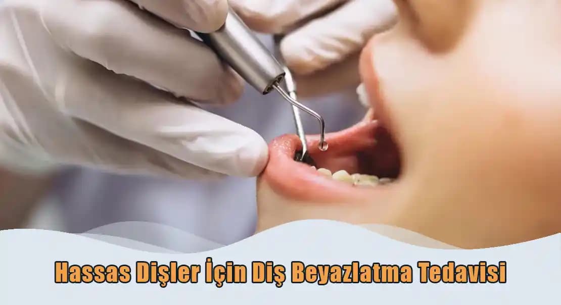 Hassas Dişler İçin Güncel Bakım ve Beyazlatma Yöntemleri Hakkında Bilgi