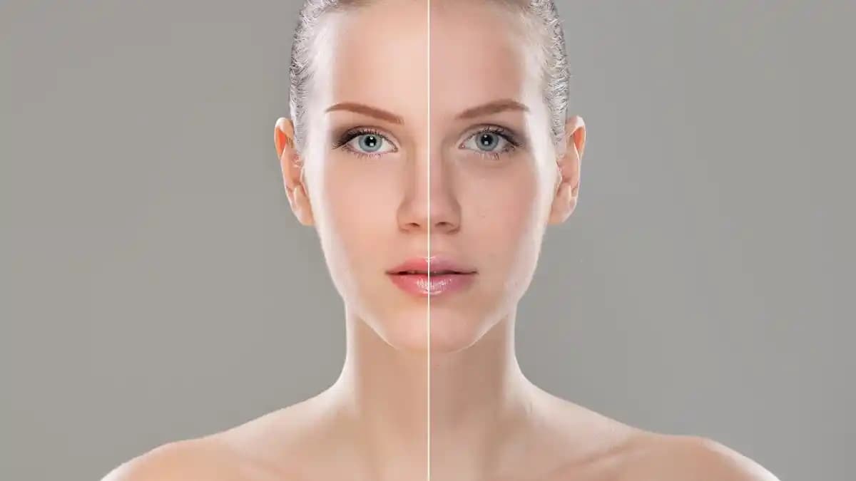 Hiperpigmentasyon ve Cilt Tonunu Eşitleme Yöntemleri: Etkili Çözümler ve Uyarılar