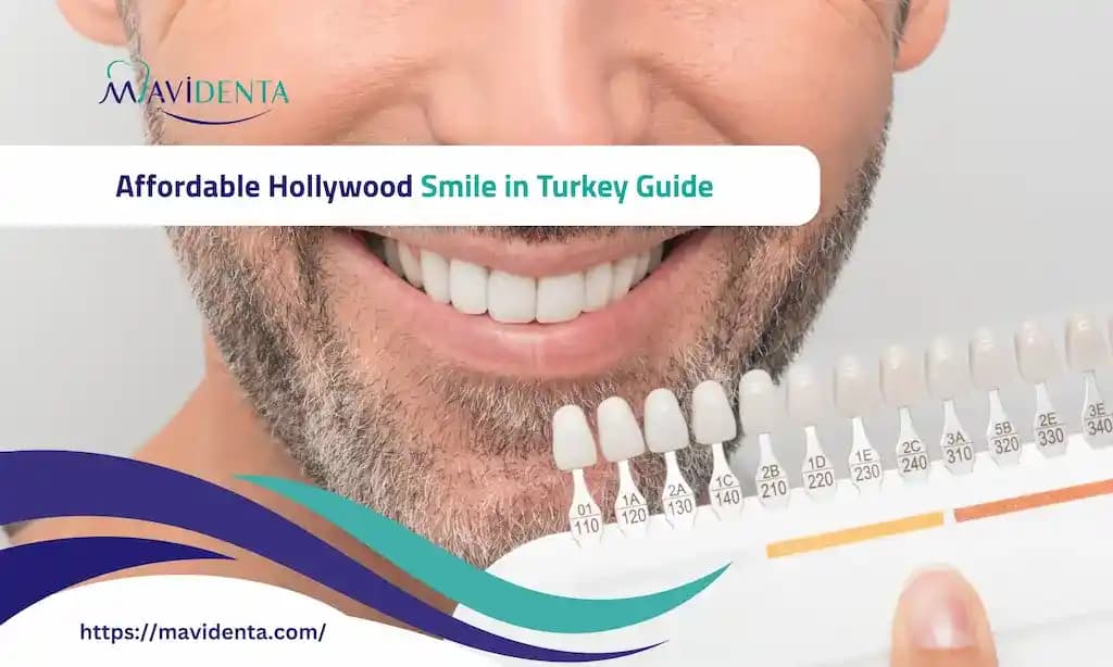 Hollywood Gülümseme İçin En İyi Alternatifler ve Doğru Ürün Seçenekleri