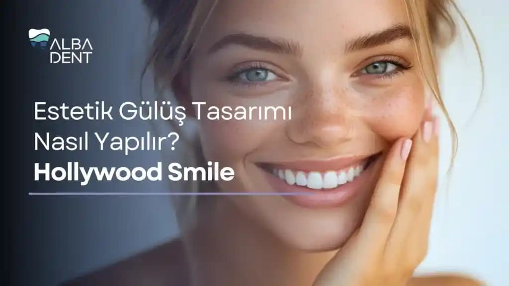 Hollywood Smile Nedir ve Sağlıklı Gülüş İçin Neler Yapılmalı