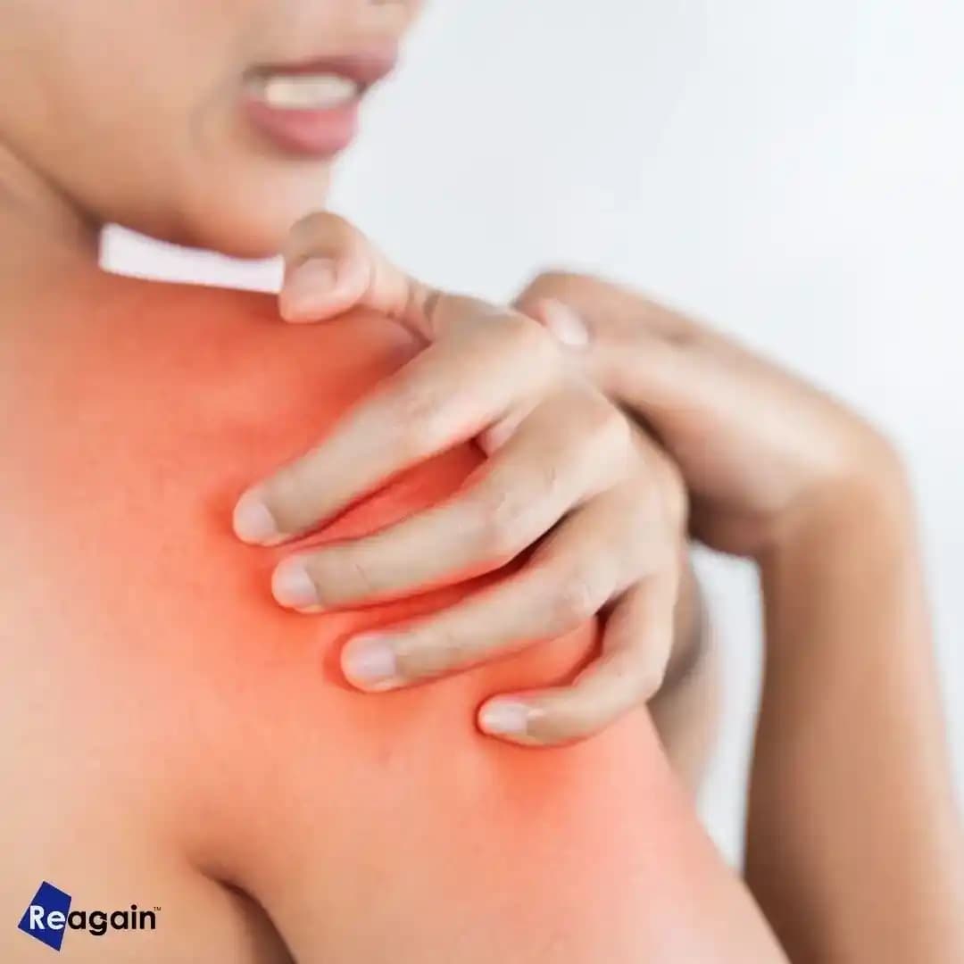 Kızarıklık Nedenleri ve Etkili Çözüm Yöntemleri Cilt Sağlığını Koruma Rehberi