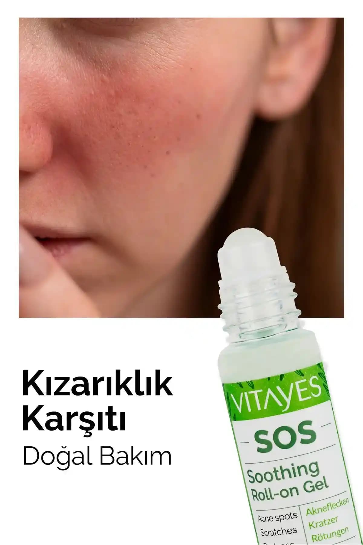 Kozmetik Ürünlerin Cilt Kaşıntısına Etkisi ve Alınabilecek Önlemler