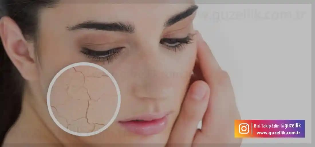 Kuru Cilt Güzelliği ve Bakımında Güncel Yaklaşımlar ve En Etkili Ürünler