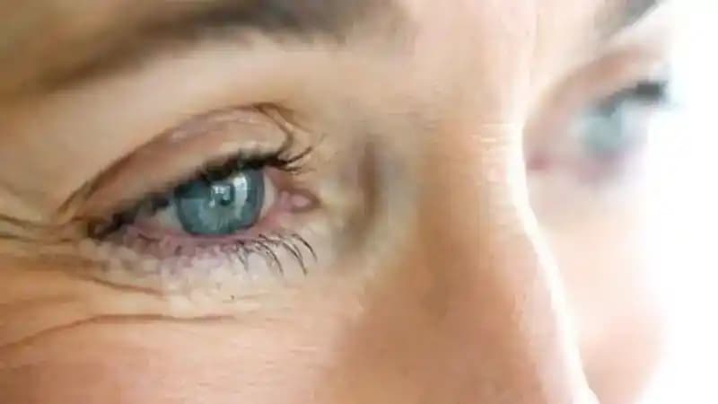 Olgun Ciltlerde Göz Çevresi ve Kaz Ayağı Bakımı: Etkili Yöntemler ve Ürünler