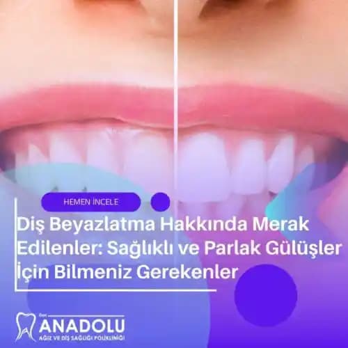 Parlak ve Doğal Gülüş İçin Bilimsel ve Pratik Yöntemler Rehberi