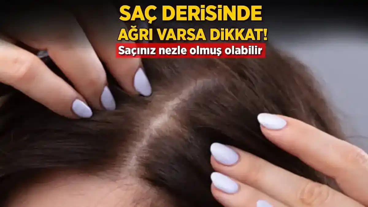 Saç Derisi Ağrılarını Hafifletmek İçin Doğal ve Kozmetik Bakım Yöntemleri