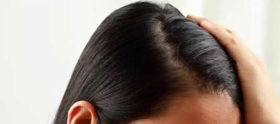 Saç Derisi Ağrısının Nedenleri ve Etkili Çözüm Yolları Hakkında Bilgiler