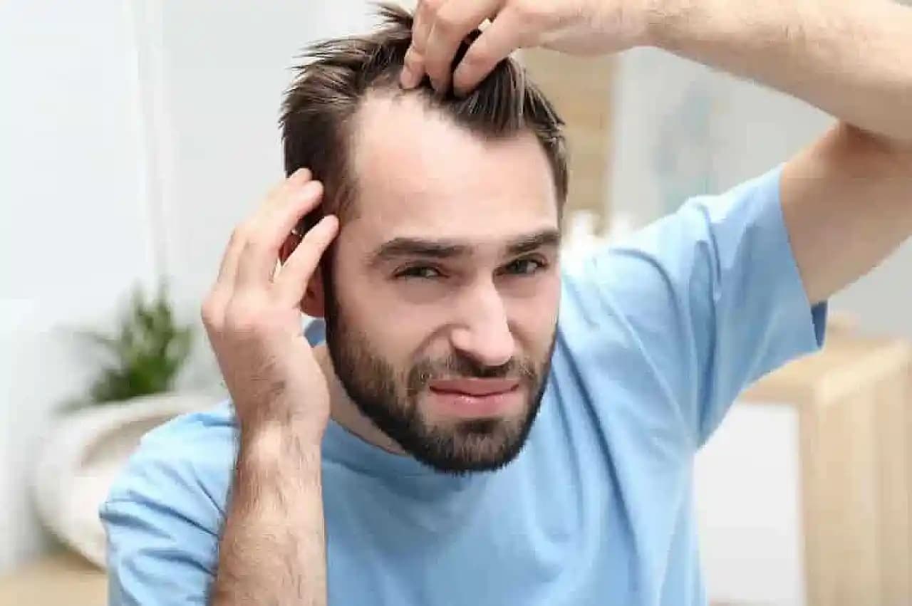 Saç Dökülmesine Karşı Doğal ve Etkili Yöntemler: Bitkisel Çözümler ve Bakım Tavsiyeleri