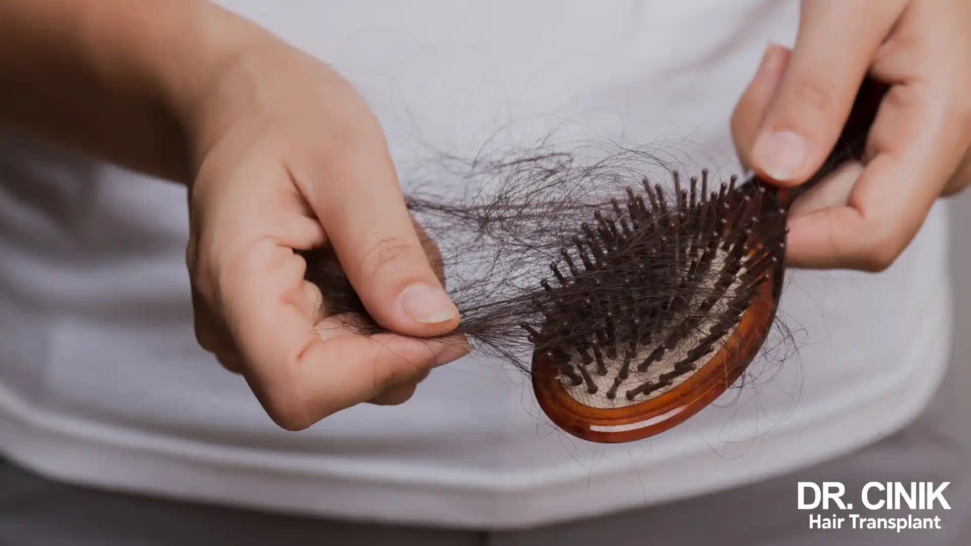 Saç Dökülmesine Karşı Doğal ve Profesyonel Çözüm Yöntemleri