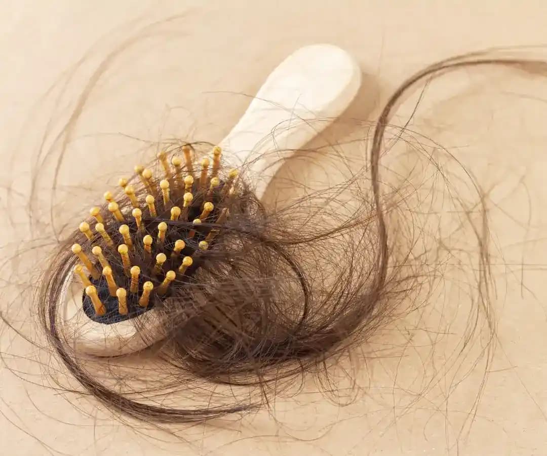 Saç Dökülmesine Karşı En Etkili Bakım Yöntemleri ve Doğal Çözümler