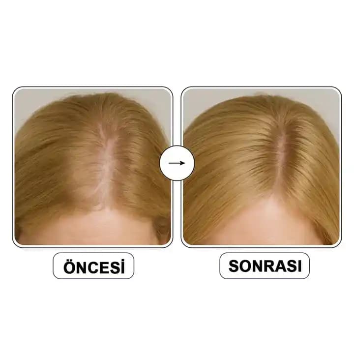 Saç Dökülmesine Karşı Güçlendirici ve Doğal Bakım Yöntemleri Rehberi