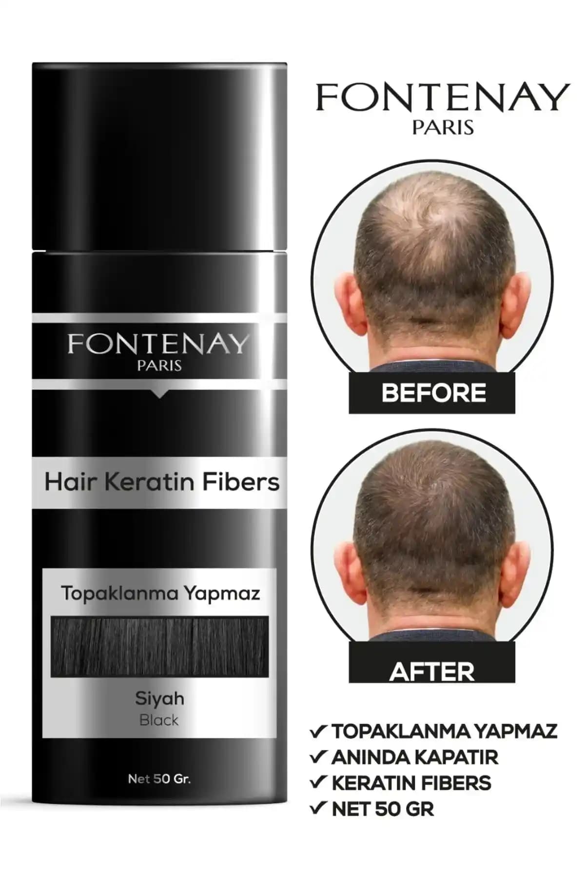 Saç Dökülmesine Karşı Topik Krem Kullanımı ve Etkileri Hakkında Bilgi