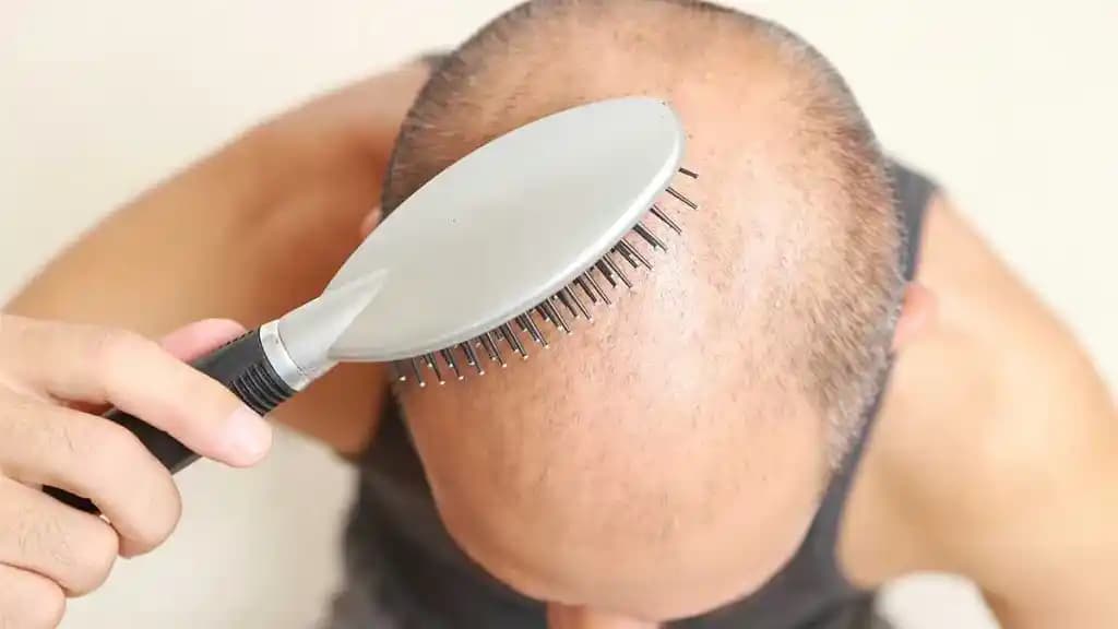 Saç Dökülmesini Önleme ve Saç Sağlığını Güçlendirme Yöntemleri