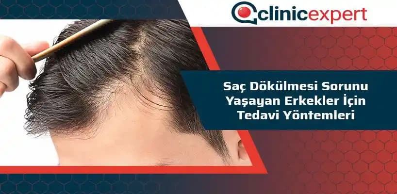 Saç Dökülmesinin Nedenleri ve Etkili Tedavi Yöntemleri Hakkında Güncel Bilgiler