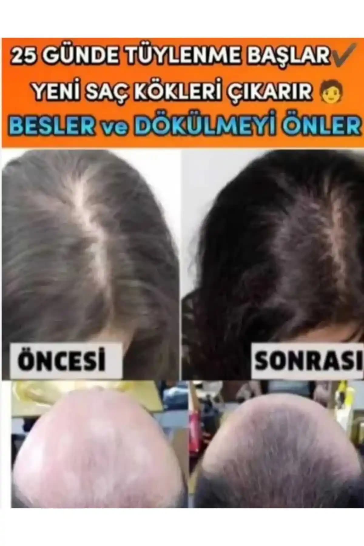 Saç Sağlığını Destekleyen Doğal Ürünler ve Bitkisel Yağlar Hakkında Bilmeniz Gerekenler