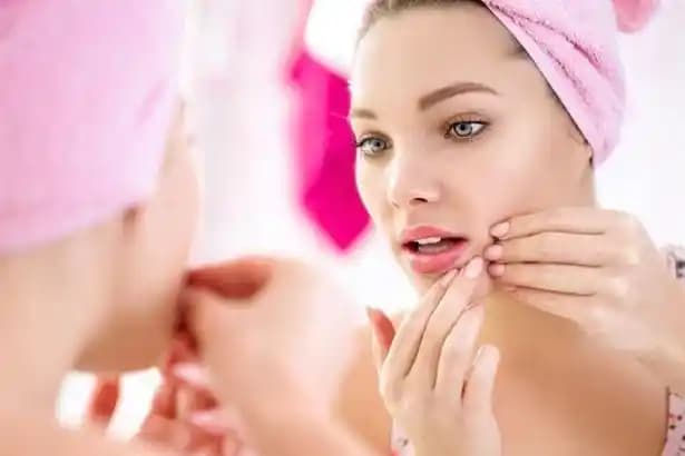 Sivilce İzleri İçin Doğal Çözüm Yöntemleri ve Cilt Bakım İpuçları