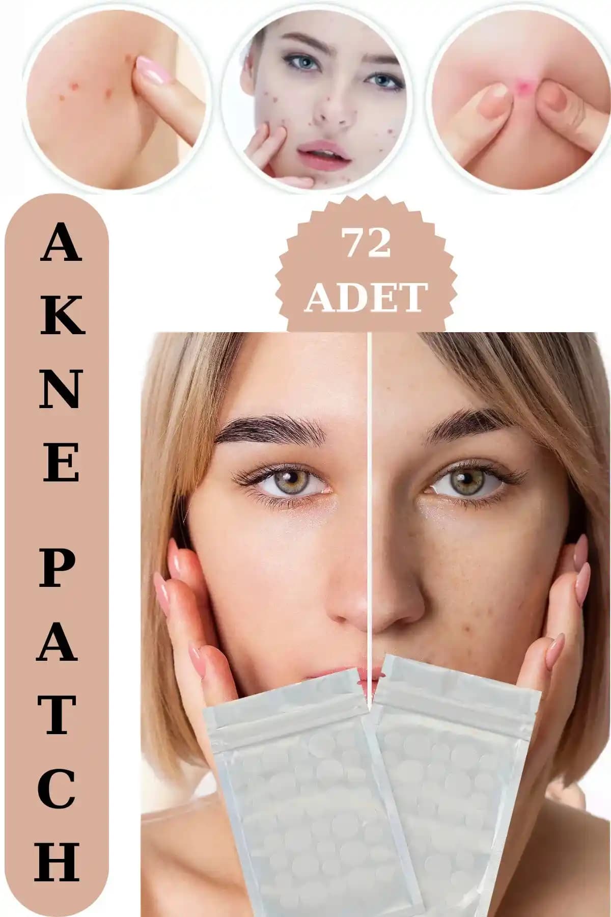 Sivilce ve Akne Tedavisinde Kullanılan Akne Bantları: Güncel Markalar ve Özellikler