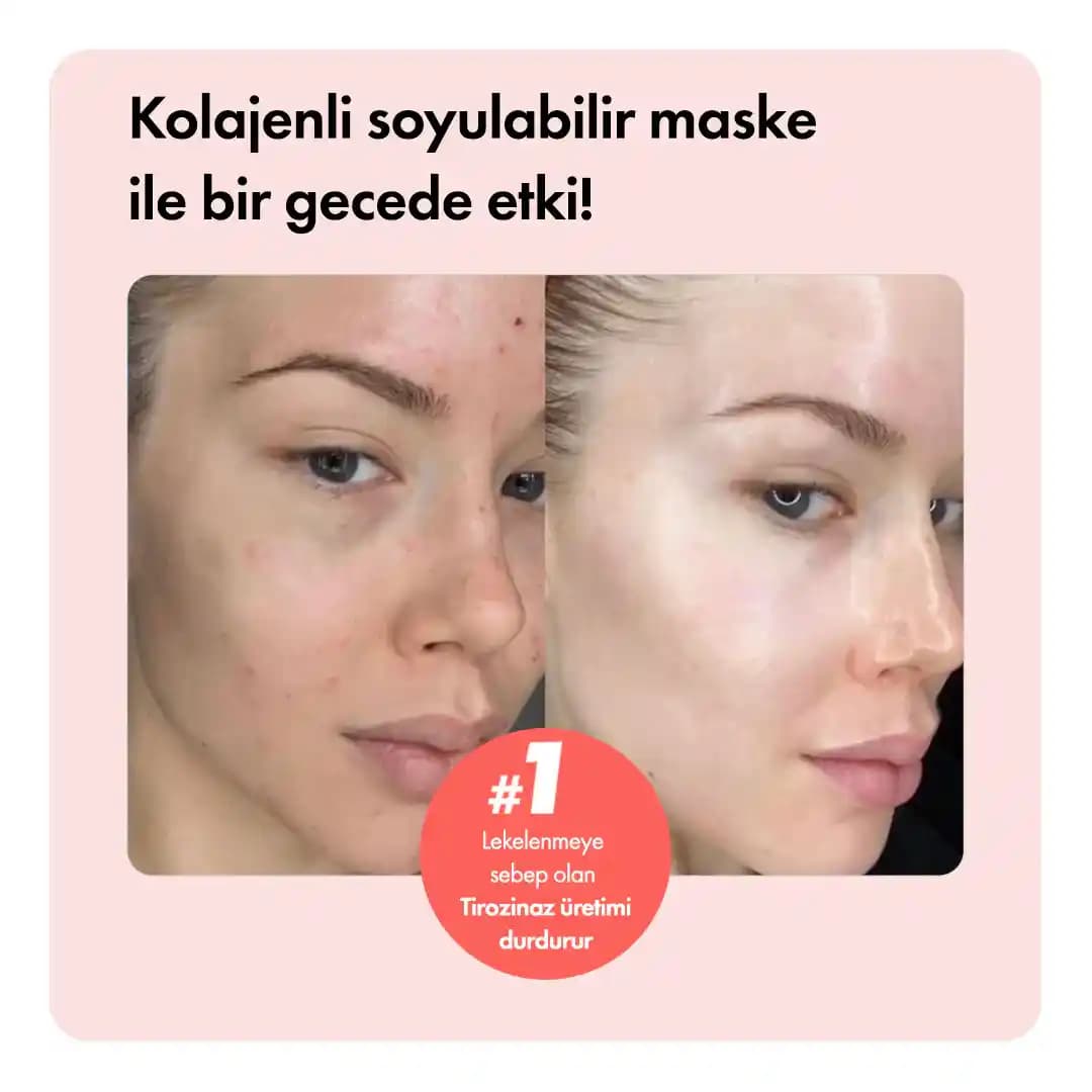 Soyulabilir Maskelerin Cilt Temizliği ve Yenilenmedeki Rolü ve Doğru Kullanım Yöntemleri