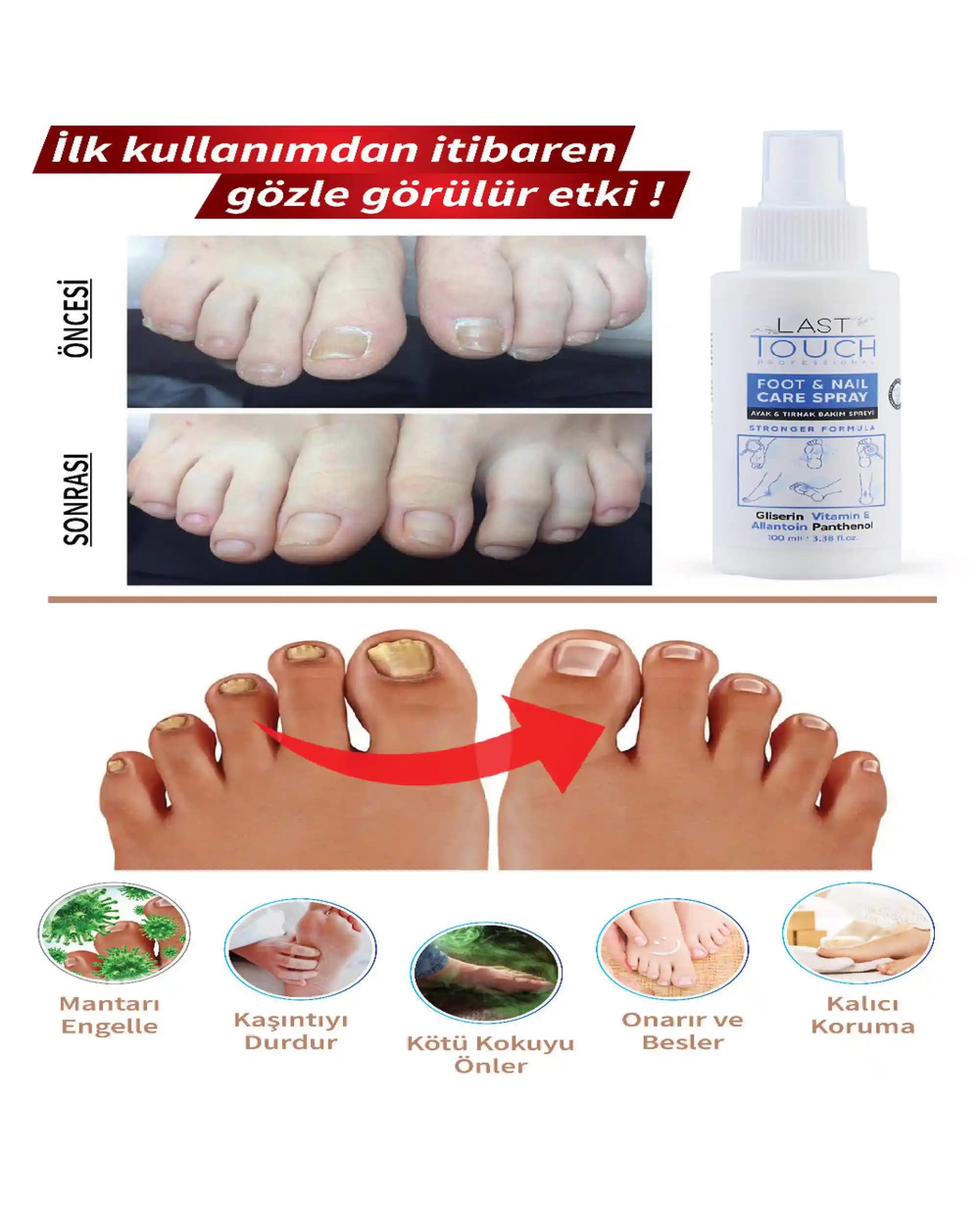 Tırnak Mantarı İçin Etkili Bakım Ürünleri ve Kullanım İpuçları