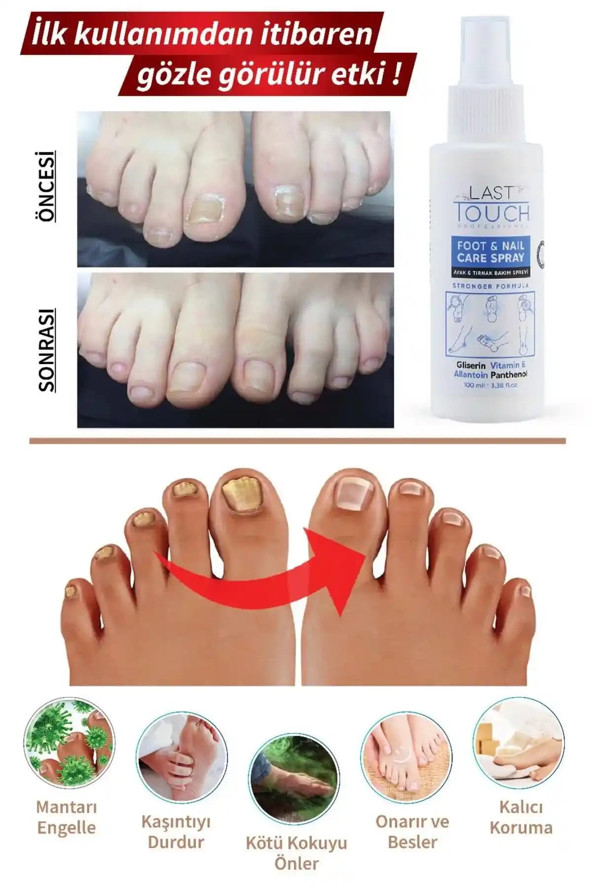 Tırnak Mantarı İçin Etkili Ürünler ve Doğru Kullanım Yöntemleri Hakkında Bilgiler