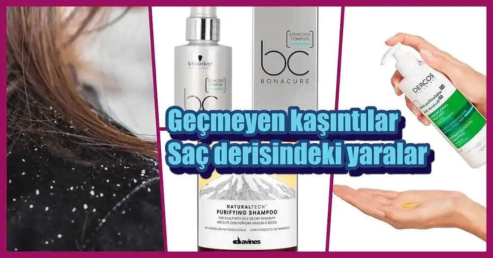 Saç Sağlığını Koruyan Doğru Şampuan Kullanımı ve Uygulama Yöntemleri