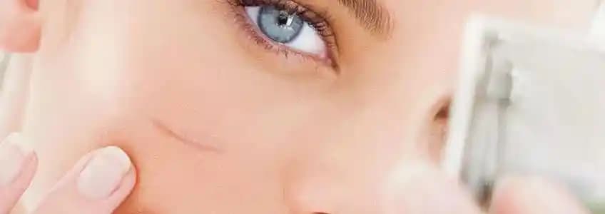 Yara İzlerini Azaltma ve Estetik Bakım Yöntemleri Hakkında Bilmeniz Gerekenler