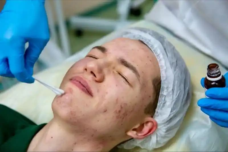 Yara İzlerinin Estetikle Azaltılması: Güncel Yöntemler ve Uygulamalar