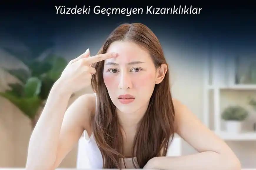 Yüzde Kızarıklık ve Kaşıntı Sorunlarının Nedenleri ve Etkili Çözüm Yöntemleri