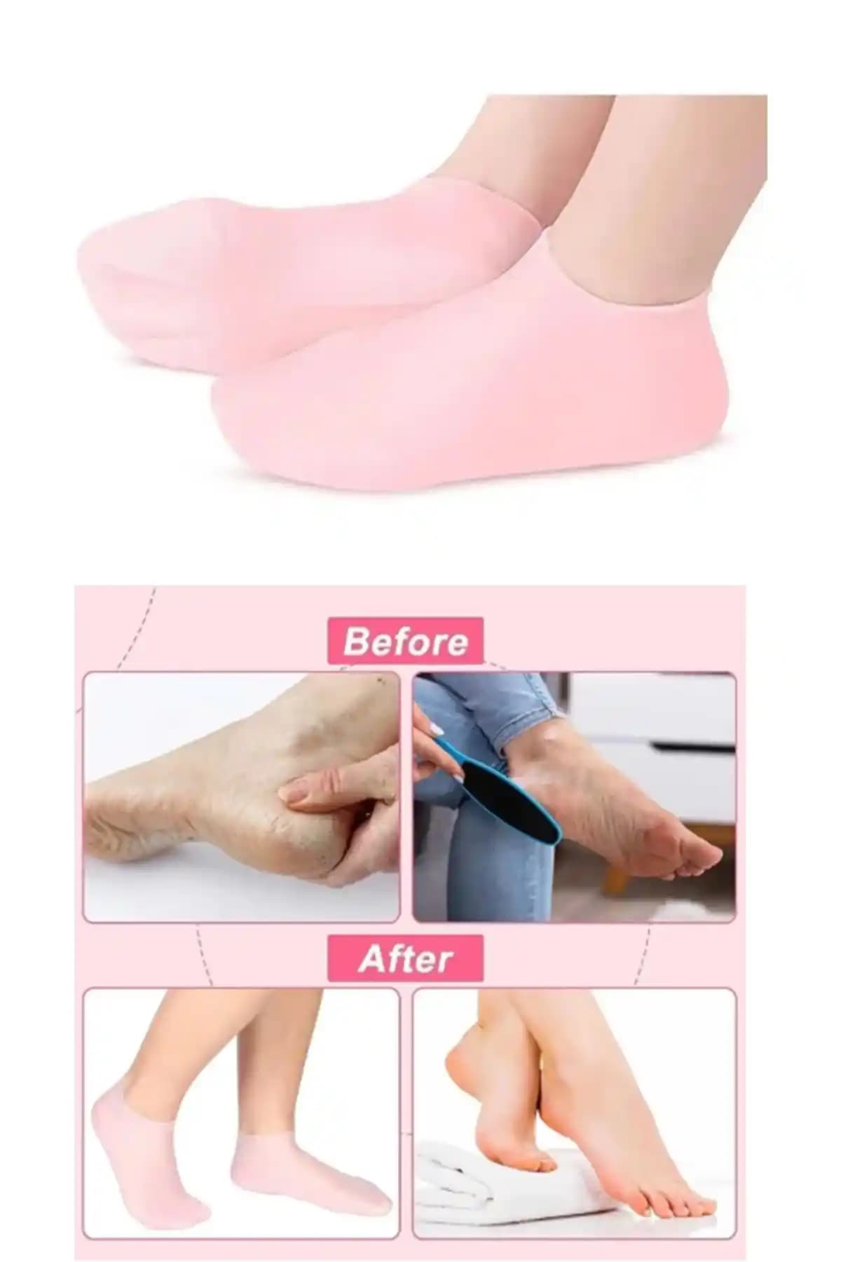 İndirimKap Silikon Nemlendirici Ayak Maskesi: Etkili ve Pratik Ayak Bakım Ürünü