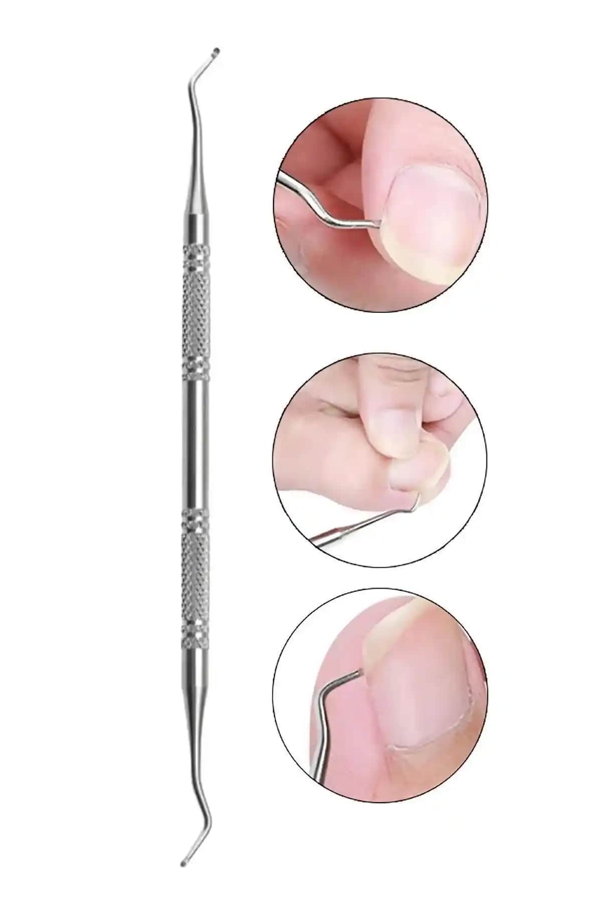 MOZIUR Küret Tırnak Batık Çıkarıcı: Güvenli ve Etkili Tırnak Sağlığı Aracı