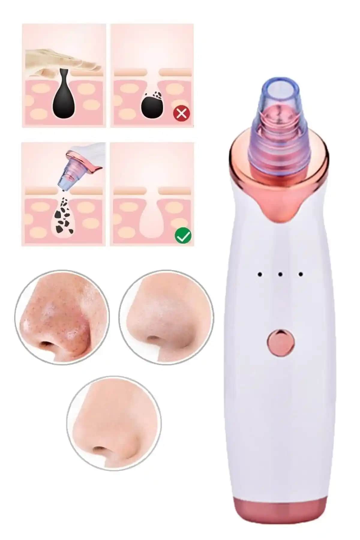 Mujgan 5 Başlıklı Vakum Cilt Temizleme Cihazı: Siyah Nokta ve Gözenek Sıkılaştırma Çözümü