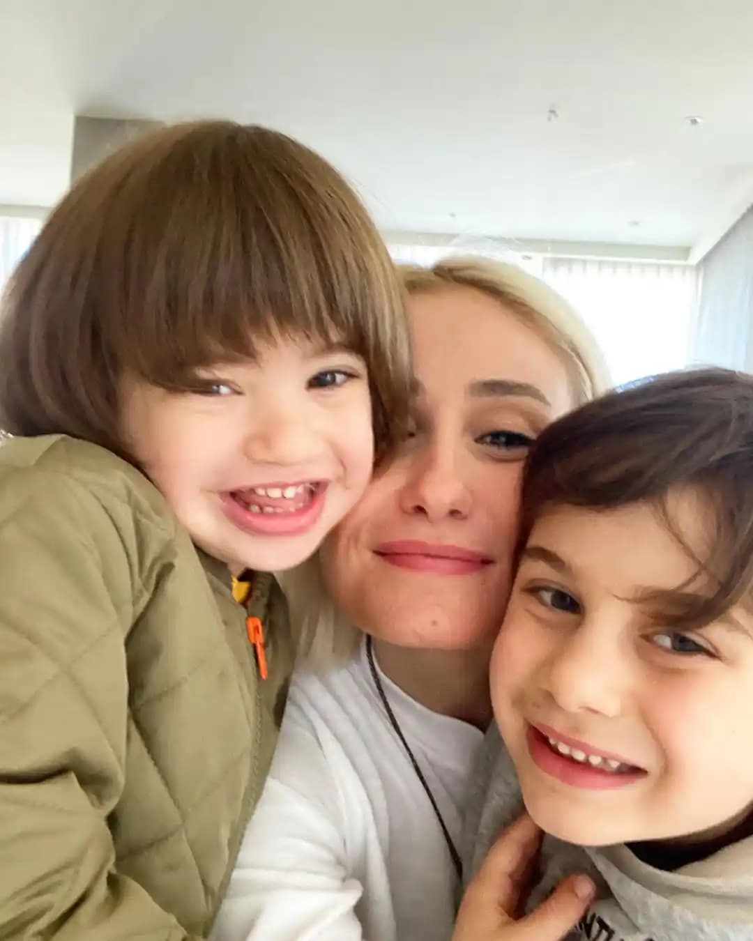 36 Yaşında Cilt Bakımı: Emzirme Sonrası Yaşlanma Belirtileri ve Güvenli Çözümler