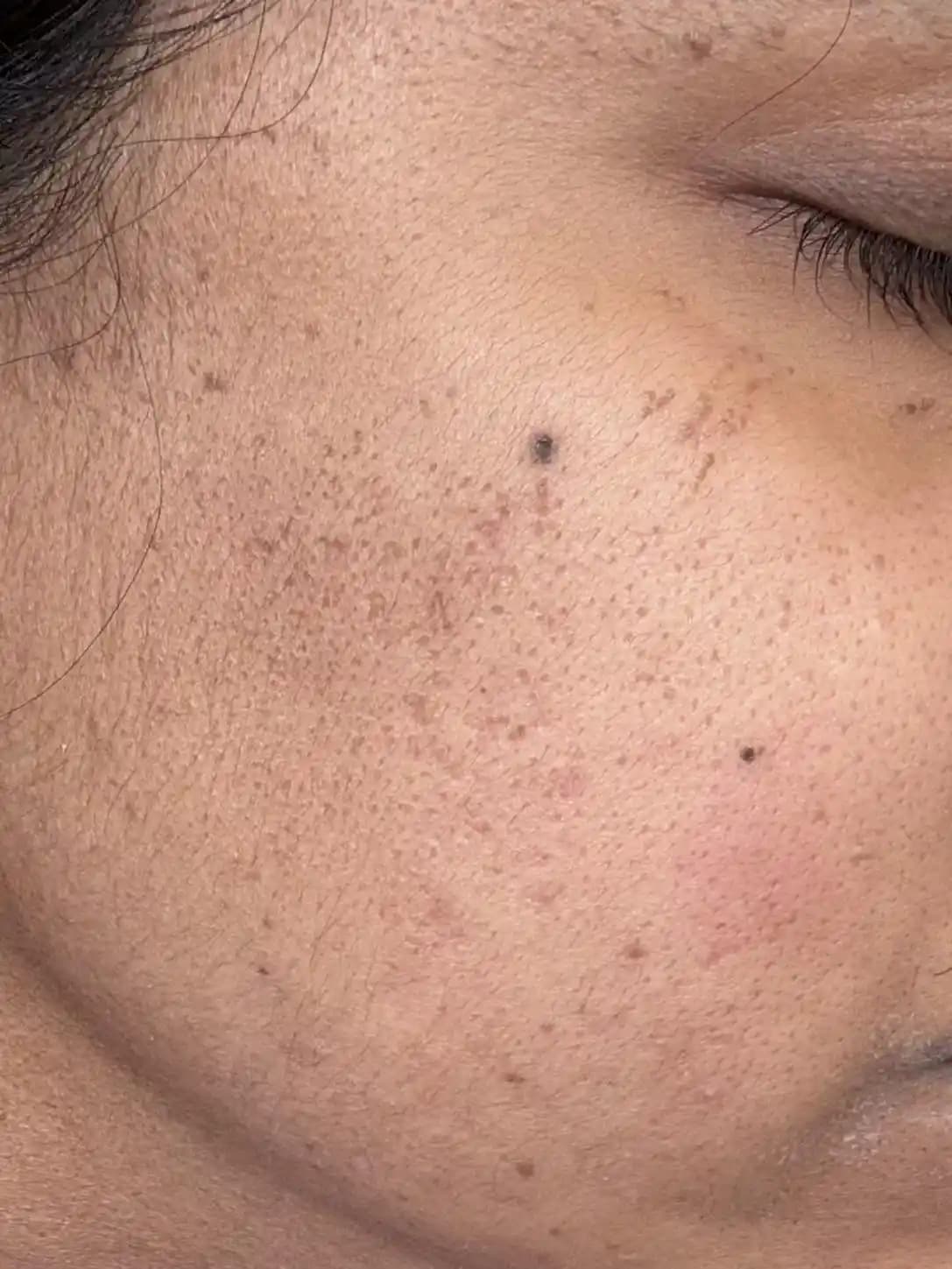 40 Yaş Üzeri Cilt Sağlığını İyileştirmek İçin Etkili Bakım Yöntemleri ve Ürünler