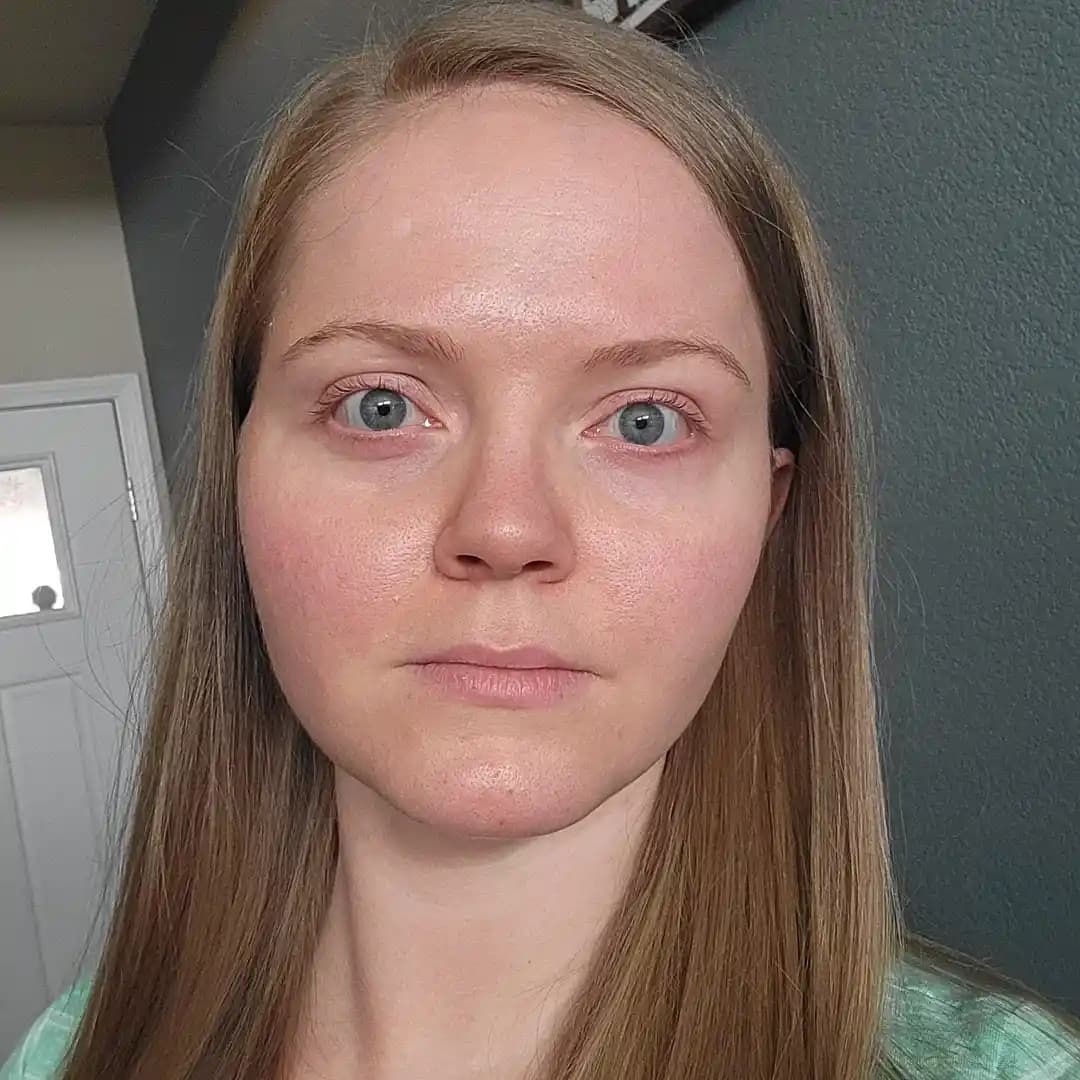 Cilt Bakımında Retinol Kullanımı, Gözenek Yönetimi ve Psikolojik Yaklaşımlar