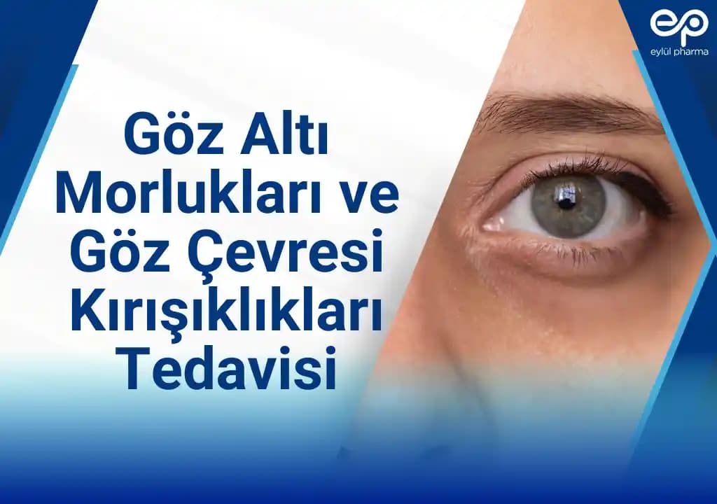 Göz Altı Şişlikleri ve Morlukları Azaltmada Etkili Yöntemler ve Tedavi Seçenekleri