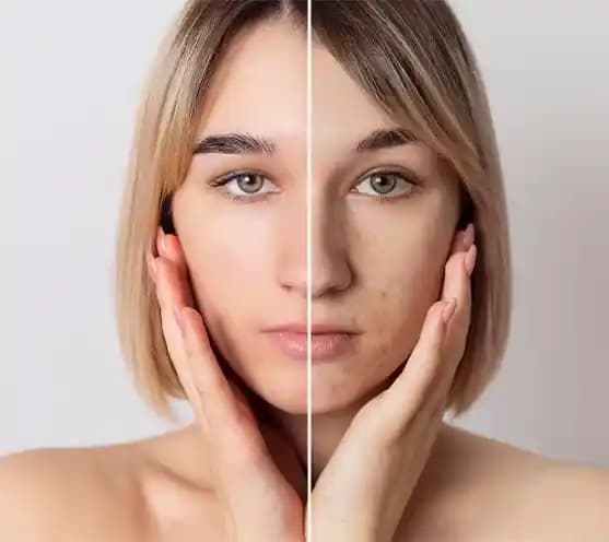 Kuru Ciltler İçin Kış Aylarında Asya Güzellik Ürünleriyle Etkili Nemlendirme ve Bariyer Bakımı