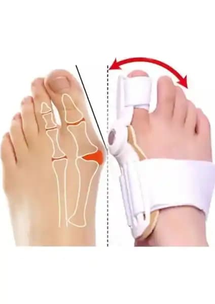 Teknotrust Halluks Ayak Baş Parmak Düzeltici: Ayak Sağlığınız İçin Etkili Çözüm
