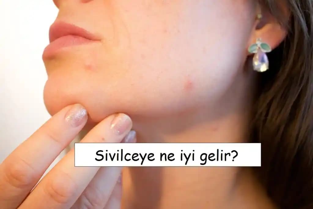 Yüzde Sivilcelerin En Ağrılı ve Rahatsız Edici Bölgeleri: Detaylı İnceleme