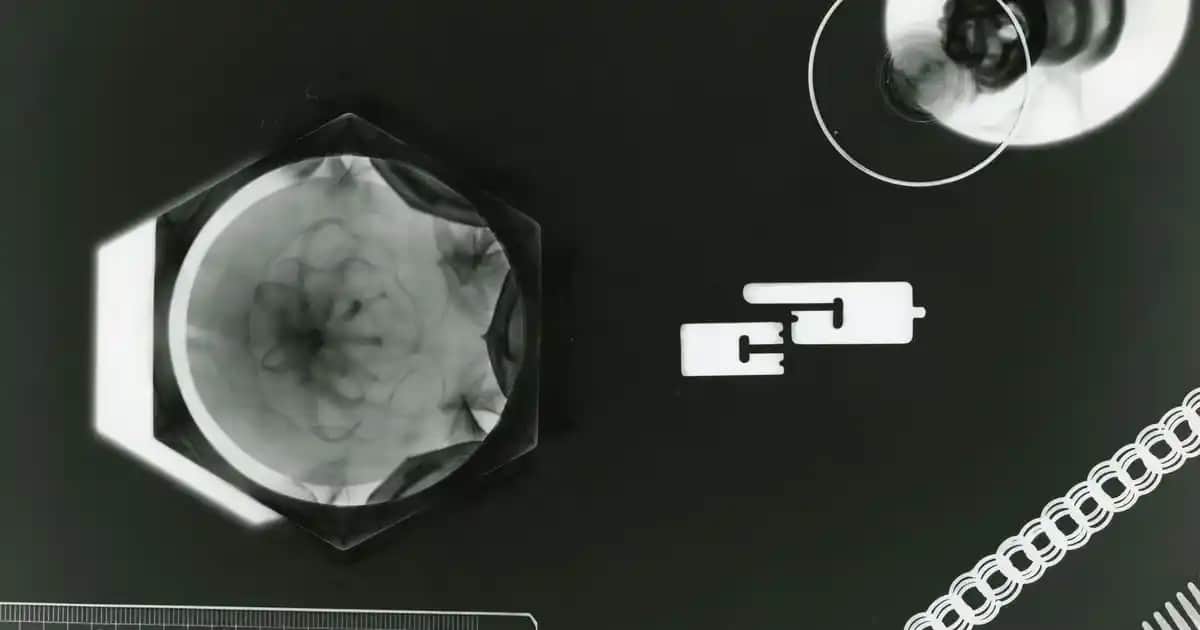 Bioxcin ile Kepeğe Karşı Etkili Çözümler Saç Sağlığınızı Güçlendiren Ürünler