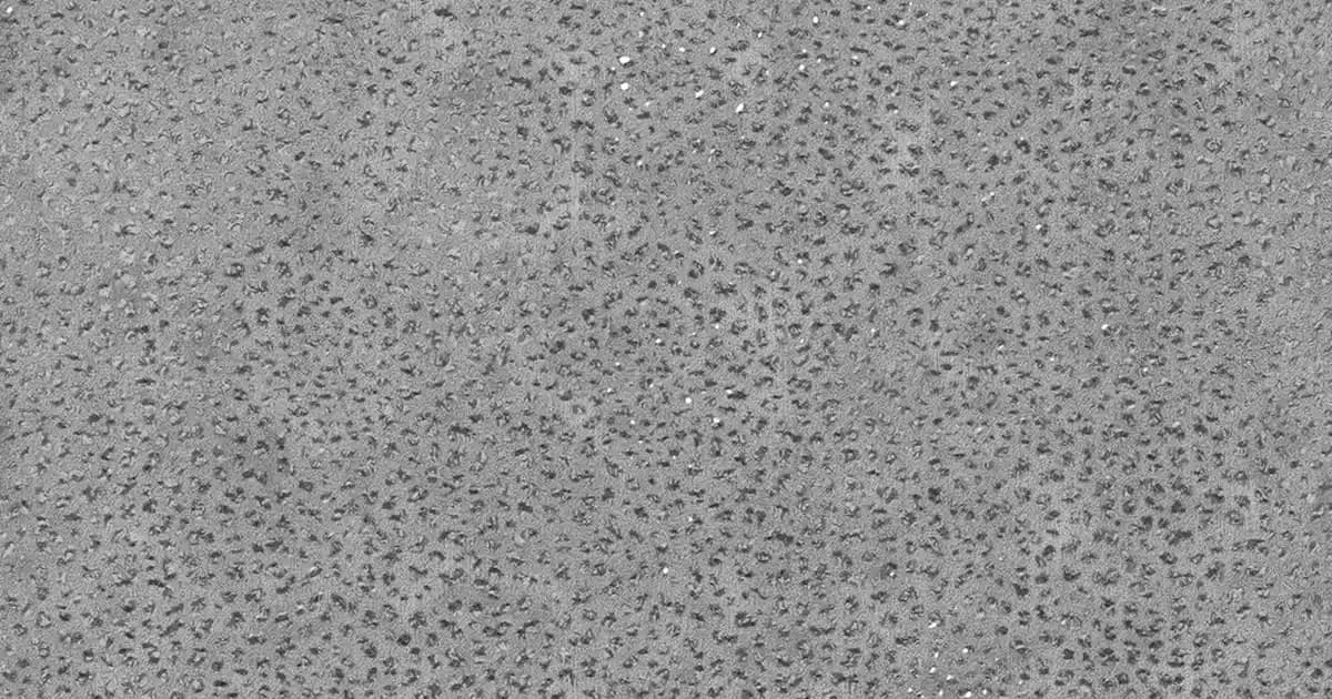 Dermoskin Acne Mat ile Akneye Eğilimli Ciltlerde Güneş Koruması ve Matlık Sağlama