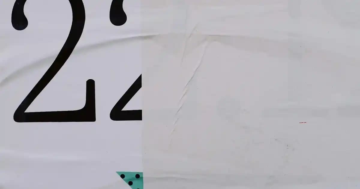 Saçta Beyaz Kepek Sorunu ve Çözüm Yolları: Nedenleri, Belirtileri ve Bakım Tavsiyeleri