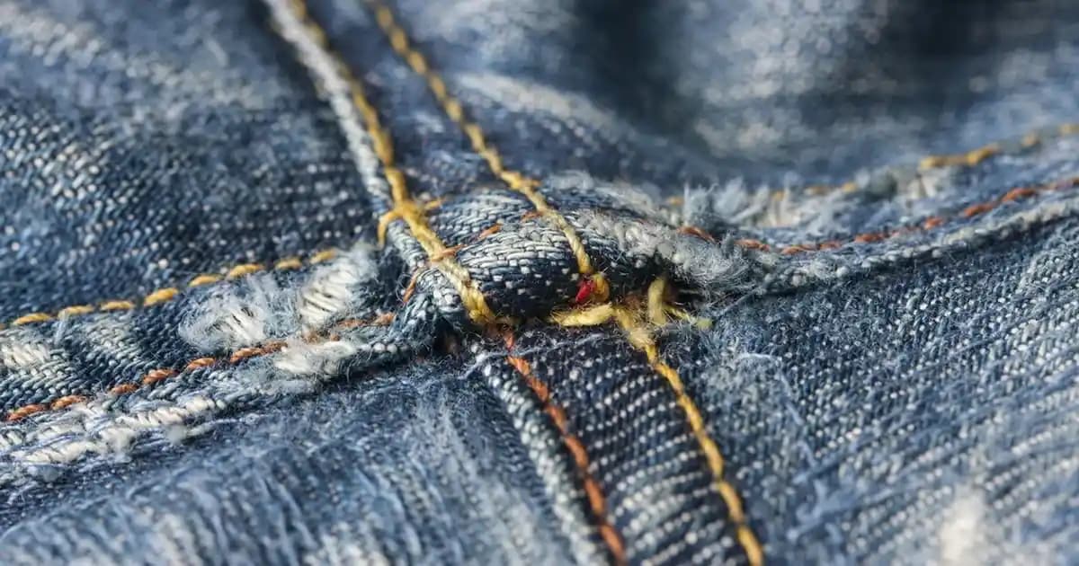 Saçta Çıkan Sivilcelerin Nedenleri ve Etkili Tedavi Yöntemleri