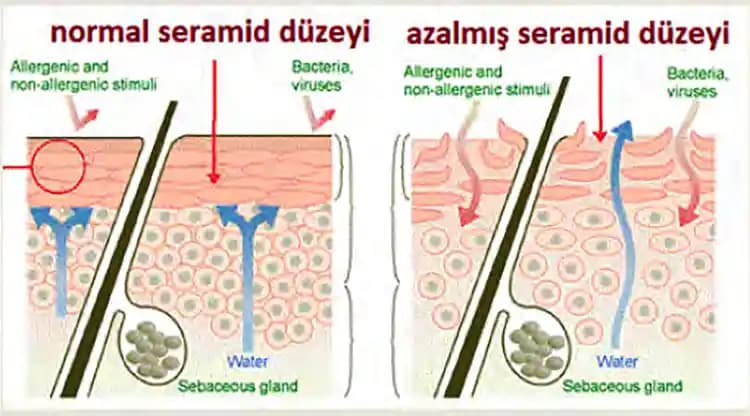 3 Temel Seramid Türü ve Cilt Bakımında Seramidlerin Önemi ve Faydaları